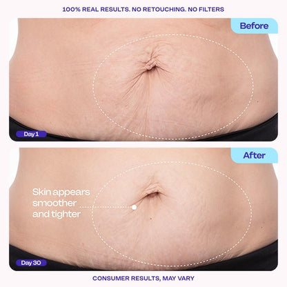 Tighten & Smooth Belly Firming Cream