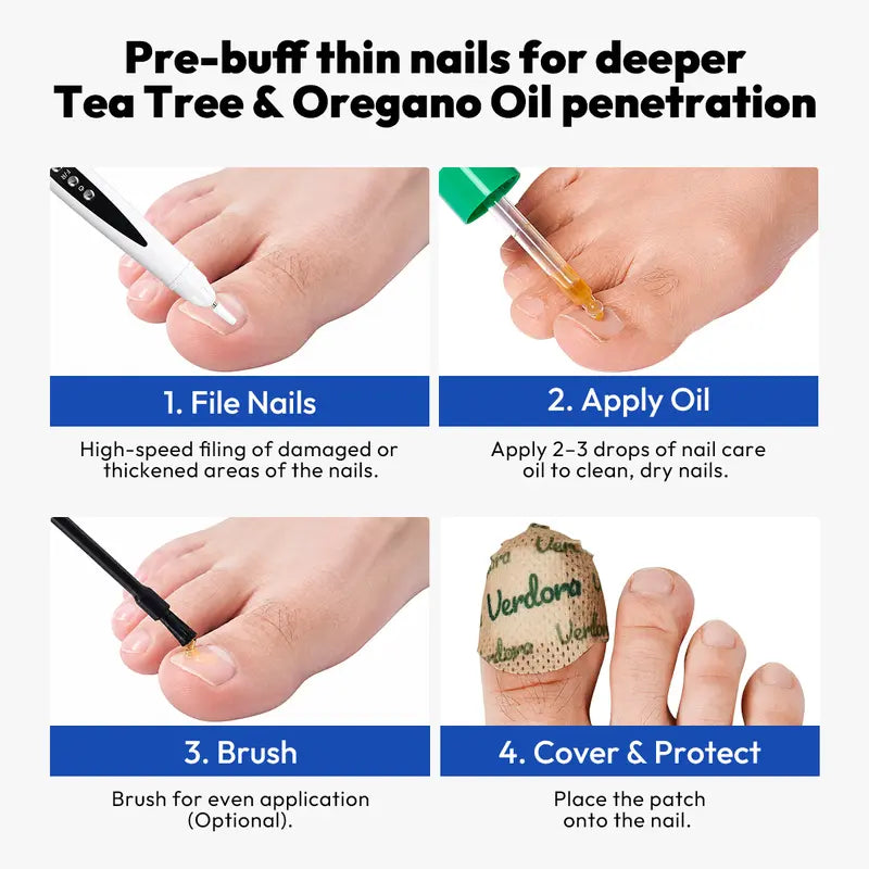 1 Set Electric Nail Drill for Thick Nails, Cordless Efiles for fungal Nails Lightweight